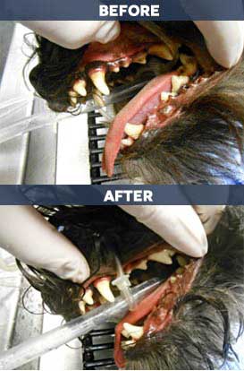 before and after of dental clean up